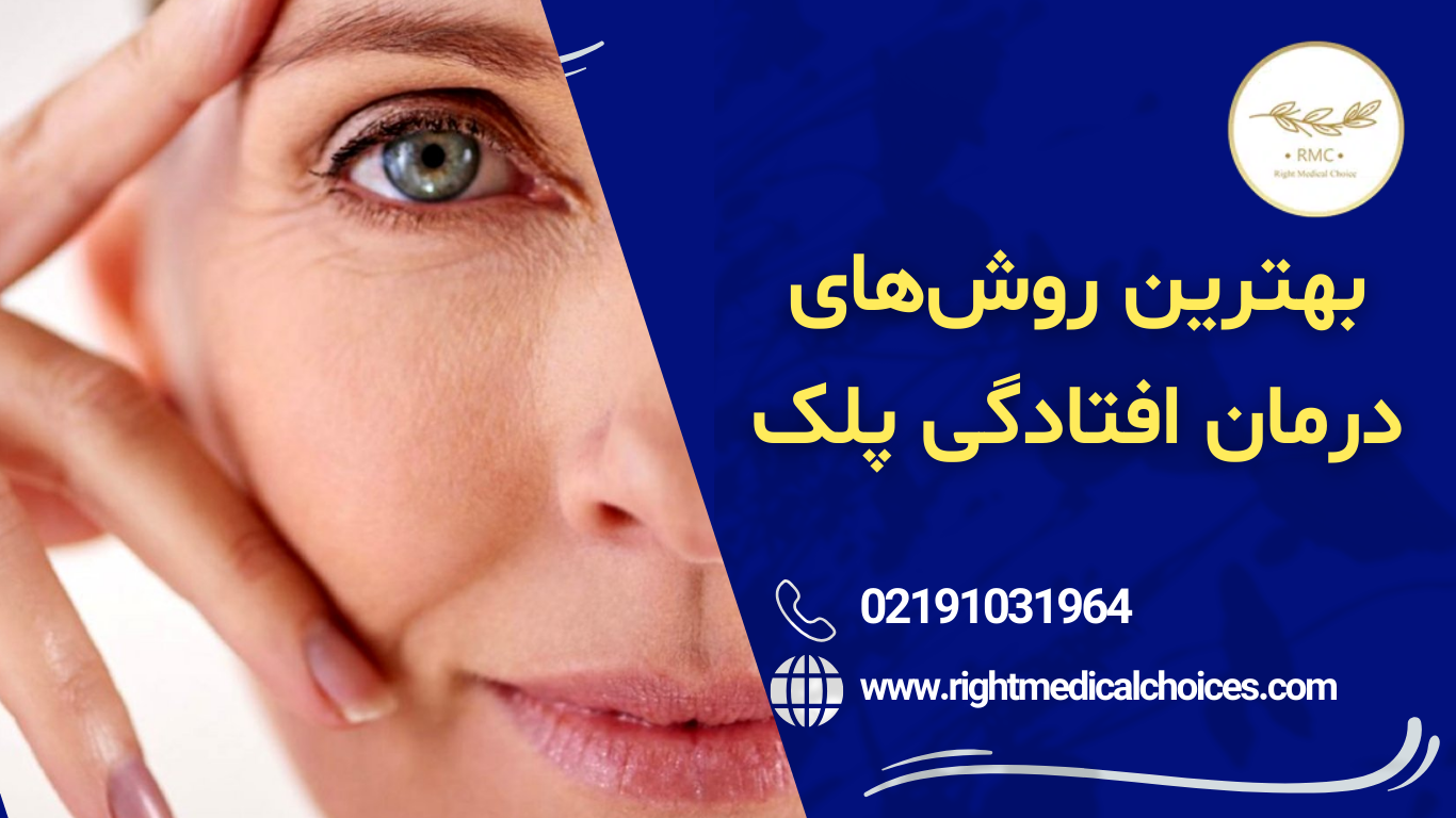 درمان پتوز پلک