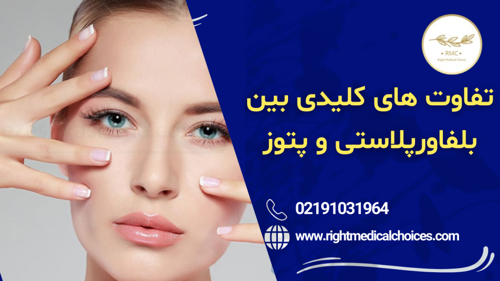 پتوز یا بلفاروپلاستی