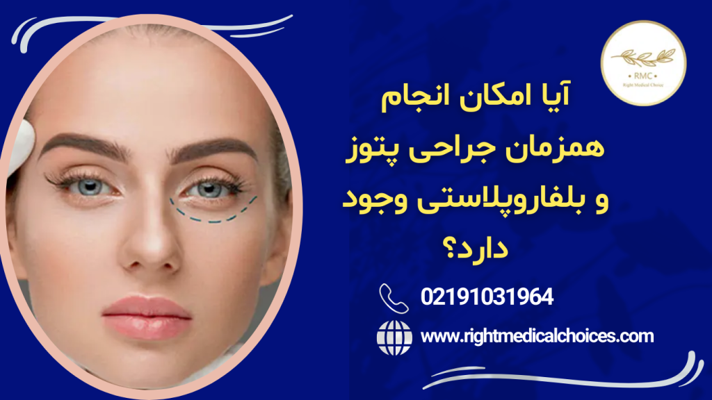 پتوز یا بلفاروپلاستی