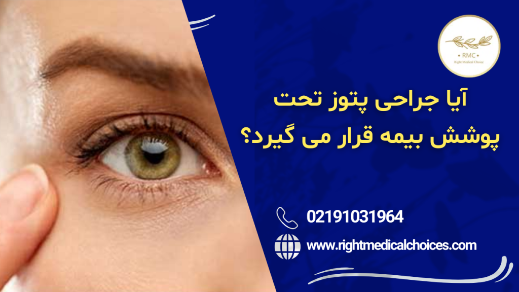 هزینه پتوز را بیمه می دهد یا نه؟