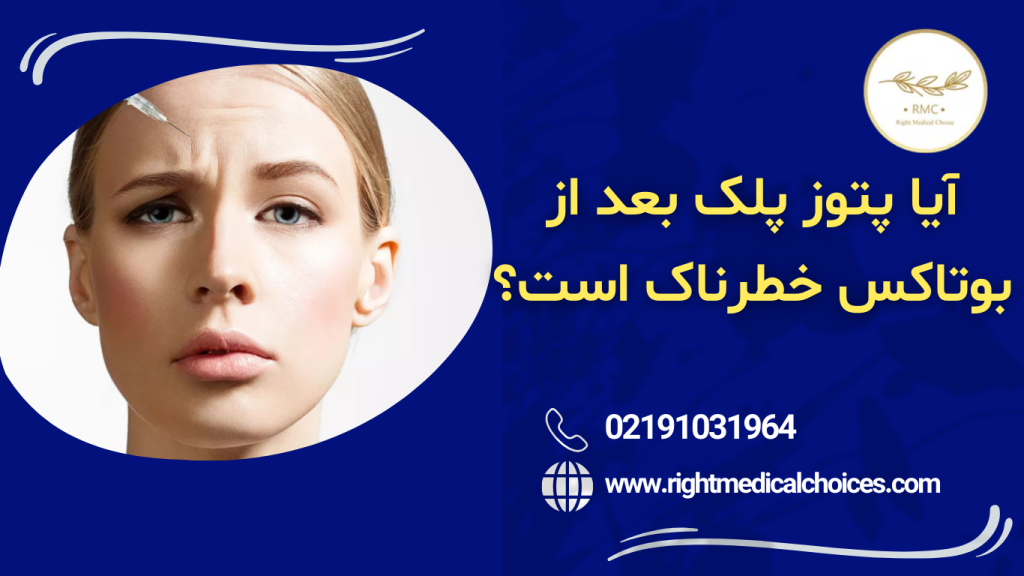 آیا پتوز بعد از بوتاکس خطرناک است
