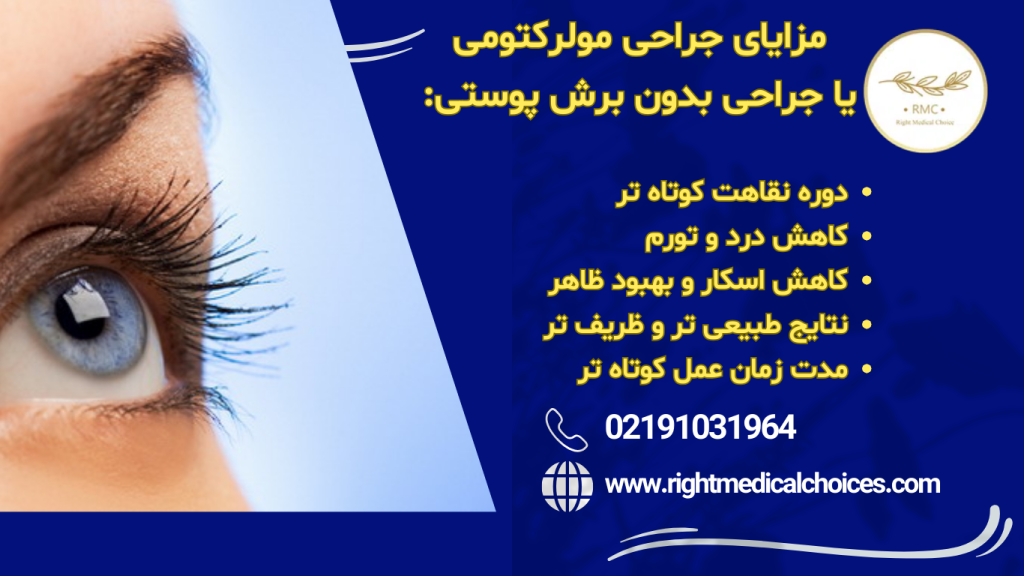 مولرکتومی در پتوز