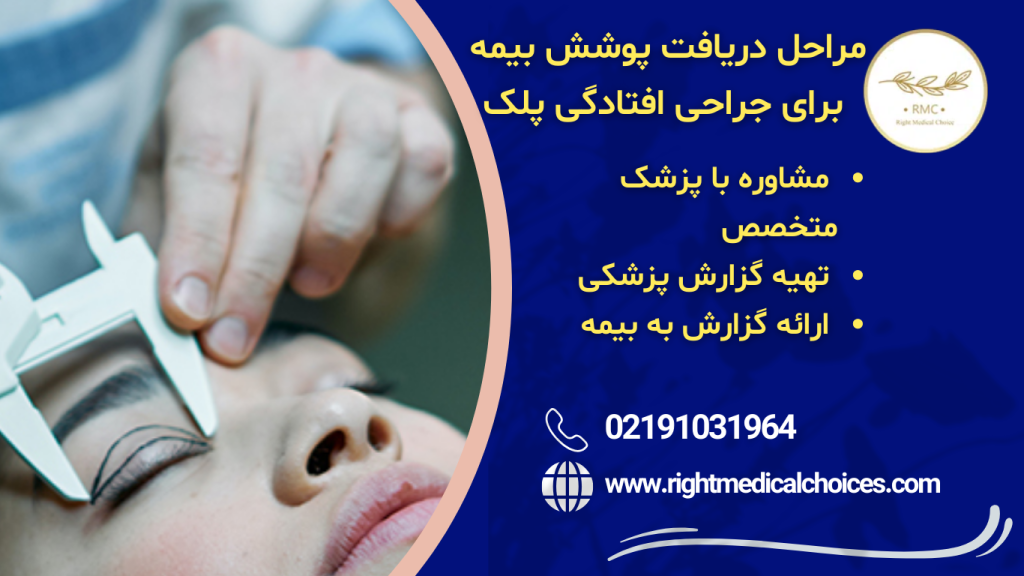 مراحل دریافت پوشش بیمه برای جراحی افتادگی پلک