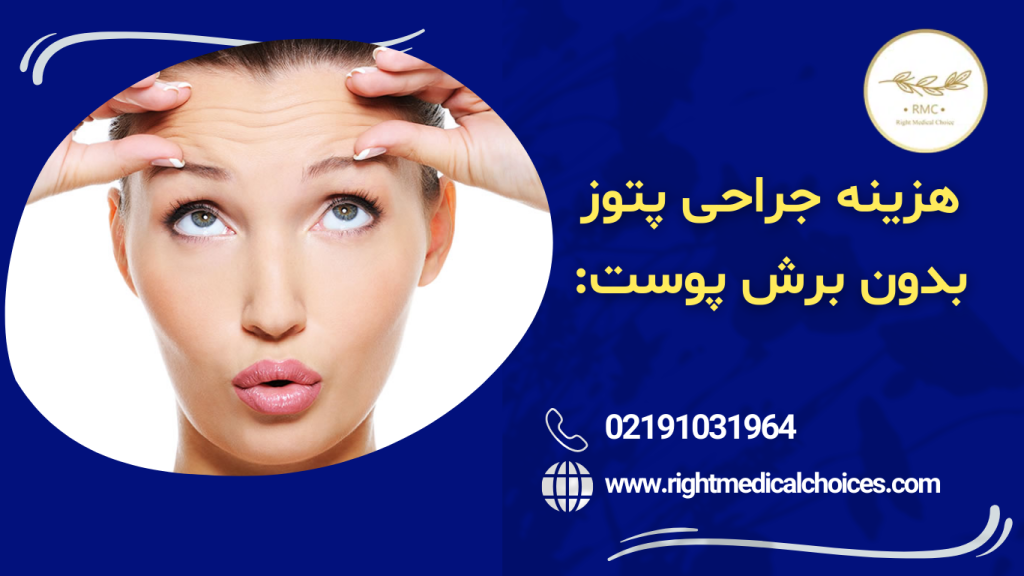 مولرکتومی در پتوز
