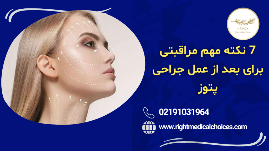 بازگشت پتوز پلک بعد از جراحی
